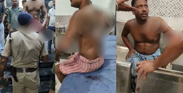 Patna Loan Dispute Petrol Attack