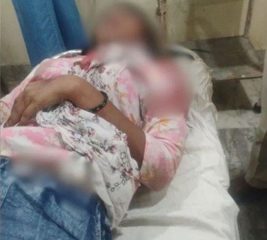 Patna girl attacked