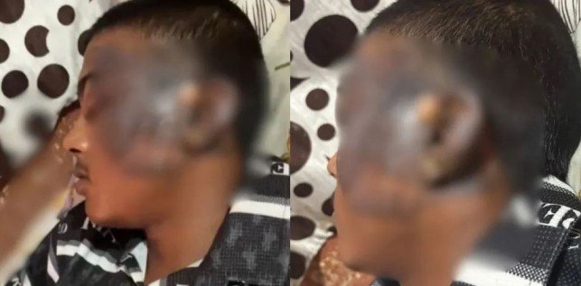 Gwalior Momo Stall Hot Oil Attack