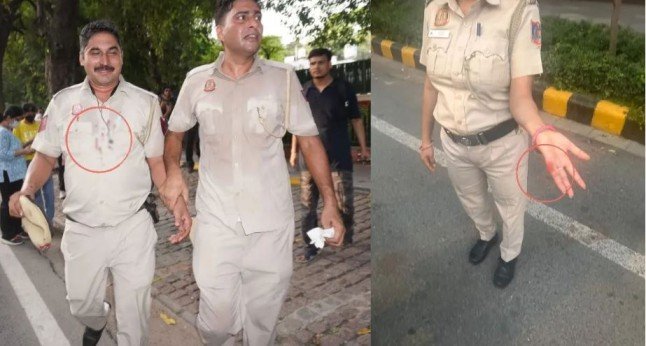 Delhi Protest Police Injured